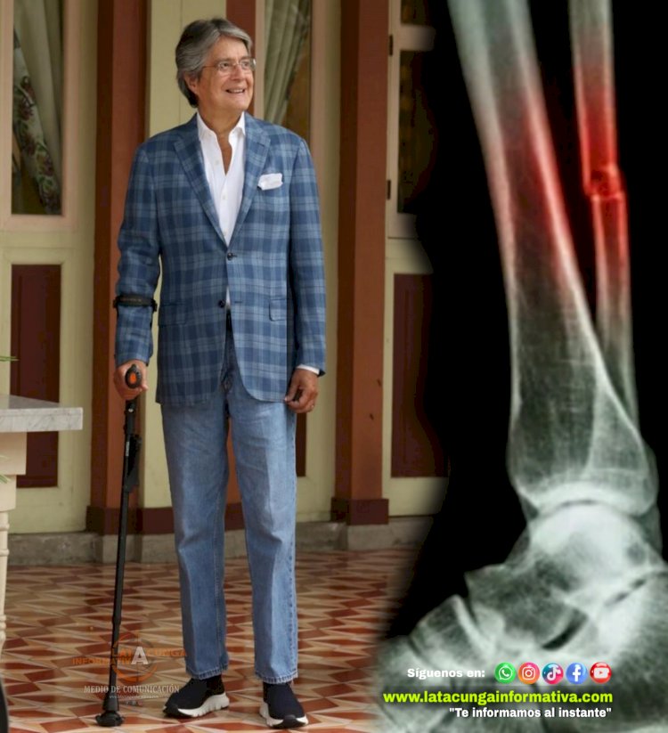 Lasso sufre fractura en su pierna izquierda y será operado