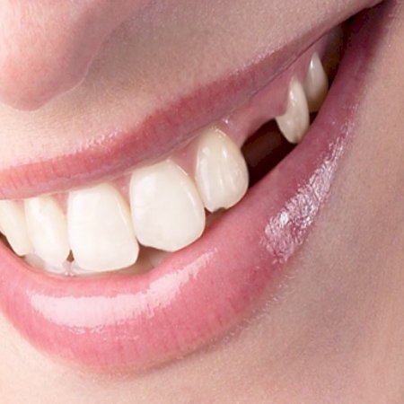 "Nueva droga promete regenerar los dientes naturalmente" 